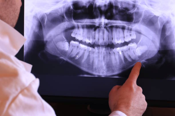 Best Dentist for Tooth Abscess  in Mosheim, TN