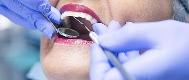 Best Knocked-Out Tooth Emergency  in Mosheim, TN